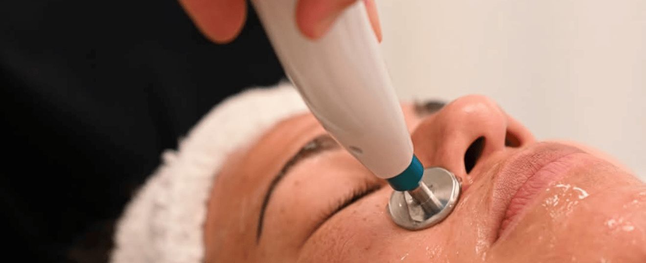 Soin Peeling Chimique – Éclat, Pureté et Régénération Cellulaire